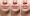 Lip flip eller läppfillers